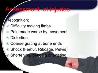 29
Assessment of injuries
Recognition;
 Difficulty moving limbs
 Pain made worse by movement
 Distortion
 Coarse grating at bone ends
 Shock (Femur, Ribcage, Pelvis)
 Shortening, bending or twisting
29
 