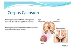 Corpus	
  Callosum	
  
The	
  corpus	
  callosum	
  forms	
  a	
  bridge	
  that	
  
connects	
  the	
  left	
  and	
  right	
  hemispheres.	
  	
  
The	
  corpus	
  callosum	
  enables	
  communication	
  
between	
  the	
  two	
  hemisperes	
  

 