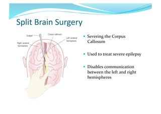Split	
  Brain	
  Surgery	
  
  Severing	
  the	
  Corpus	
  

Callosum	
  

  Used	
  to	
  treat	
  severe	
  epilepsy	
  
  Disables	
  communication	
  

between	
  the	
  left	
  and	
  right	
  
hemispheres	
  

 