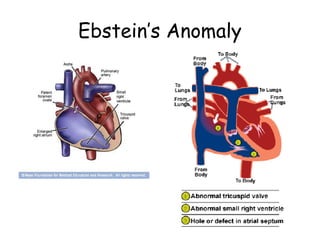 NATUNGA RONALD.Cardiovascular_System.ppt