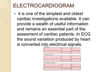 ELECTROCARDIOGRAM
 it is one of the simplest and oldest
cardiac investigations available. It can
provide a wealth of useful information
and remains an essential part of the
assesment of cardiac patients. In ECG
the sound variaition produced by heart
is converted into electrical signals.
 
