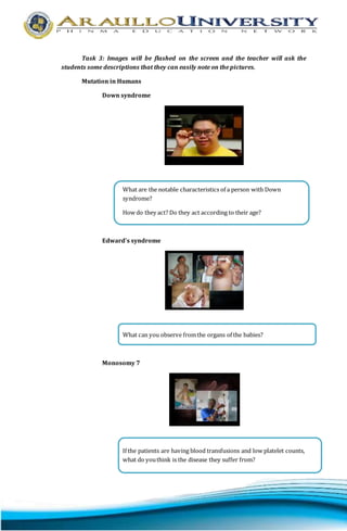 Task 3: Images will be flashed on the screen and the teacher will ask the 
students some descriptions that they can easily note on the pictures. 
Mutation in Humans 
Down syndrome 
What are the notable characteristics of a person with Down 
syndrome? 
How do they act? Do they act according to their age? 
Edward’s syndrome 
What can you observe from the organs of the babies? 
Monosomy 7 
If the patients are having blood transfusions and low platelet counts, 
what do you think is the disease they suffer from? 
 