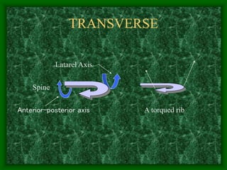 TRANSVERSE
Spine
Anterior-posterior axis
Latarel Axis
A torqued rib
 