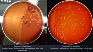 Streptococcus pyogenes
Colonies petites, blanches (tete d’épingle) avec large zone
d’hémolyse β
Streptococcus agalactiae
Colonies de 3 a 4mm grises avec zone étroite d’hémolyse β
 