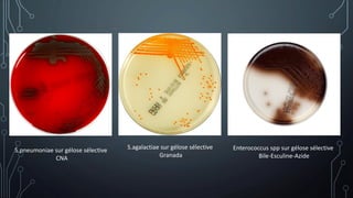 S.pneumoniae sur gélose sélective
CNA
S.agalactiae sur gélose sélective
Granada
Enterococcus spp sur gélose sélective
Bile-Esculine-Azide
 