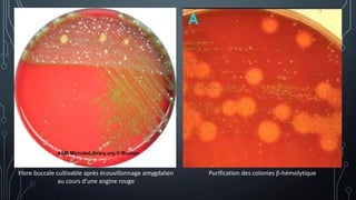 Flore buccale cultivable après écouvillonnage amygdalien
au cours d’une angine rouge
Purification des colonies β-hémolytique
 