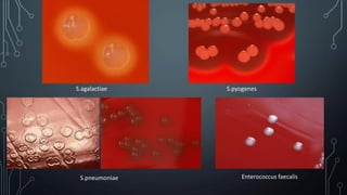Les streptocoques / Streptococcus / Enterococcus | PPT