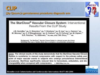 CLIP

Clip Closure in percutaneous procedures diagnostic arm

 
