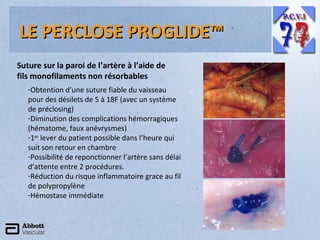 LE PERCLOSE PROGLIDE™
Suture sur la paroi de l’artère à l’aide de
fils monofilaments non résorbables
-Obtention d’une suture fiable du vaisseau
pour des désilets de 5 à 18F (avec un système
de préclosing)
-Diminution des complications hémorragiques
(hématome, faux anévrysmes)
-1er lever du patient possible dans l’heure qui
suit son retour en chambre
-Possibilité de reponctionner l’artère sans délai
d’attente entre 2 procédures.
-Réduction du risque inflammatoire grace au fil
de polypropylène
-Hémostase immédiate

 