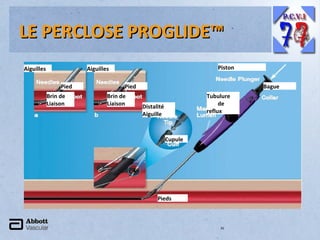 LE PERCLOSE PROGLIDE™
Aiguilles

Piston

Aiguilles
Pied
Brin de
Liaison

Pied
Brin de
Liaison

Bague
Tubulure
de
reflux

Distalité
Aiguille

Cupule

Pieds

35

 