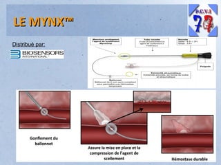 LE MYNX™
Distribué par:

 