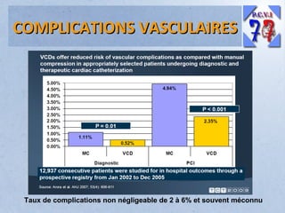 COMPLICATIONS VASCULAIRES

Taux de complications non négligeable de 2 à 6% et souvent méconnu

 