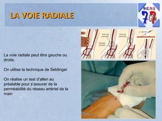 LA VOIE RADIALE

La voie radiale peut être gauche ou
droite.
On utilise la technique de Seldinger
On réalise un test d’allen au
préalable pour s’assurer de la
perméabilité du réseau artériel de la
main

 
