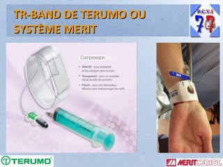 TR-BAND DE TERUMO OU
SYSTÈME MERIT

 