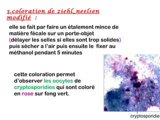 3.coloration de ziehl_neelsen
modifié :
elle se fait par faire un étalement mince de
matière fécale sur un porte-objet
(délayer les selles si elles sont trop solides)
puis sécher a l’air puis ensuite le fixer au
méthanol pendant 5 minutes



  cette coloration permet
  d’observer les oocytes de
  cryptosporidies qui sont coloré
  en rose sur fong vert.
 