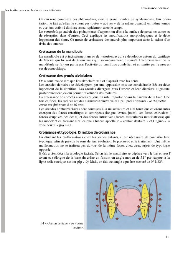Les Traitements Orthodontiques Precoces