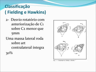 Classificação
( Fielding e Hawkins)
2- Desvio rotatório com
anteriorização de C1
sobre C2 menor que
5mm
Uma massa lateral roda
sobre art
contralateral íntegra
30%
 