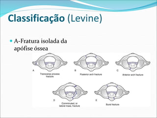 Classificação (Levine)
 A-Fratura isolada da
apófise óssea
 