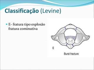 Classificação (Levine)
 E- fratura tipo explosão
fratura cominutiva
 