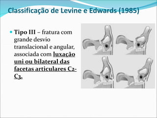 Classificação de Levine e Edwards (1985)
 Tipo III – fratura com
grande desvio
translacional e angular,
associada com luxação
uni ou bilateral das
facetas articulares C2-
C3.
 