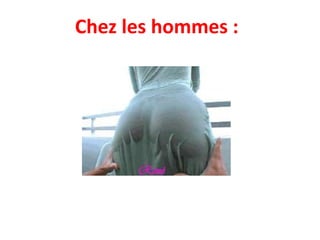 Chez les hommes : 
 