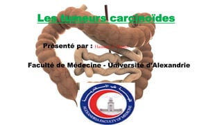 Les tumeurs carcinoïdes
Présenté par : Hassane A. Nasser
Faculté de Médecine - Université d'Alexandrie
 