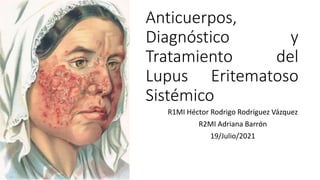 Anticuerpos,
Diagnóstico y
Tratamiento del
Lupus Eritematoso
Sistémico
R1MI Héctor Rodrigo Rodríguez Vázquez
R2MI Adriana Barrón
19/Julio/2021
 