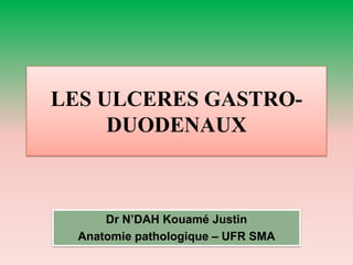 LES ULCERES GASTRO-
DUODENAUX
Dr N’DAH Kouamé Justin
Anatomie pathologique – UFR SMA
 