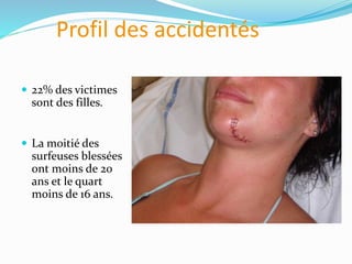 Profil des accidentés
 22% des victimes
sont des filles.
 La moitié des
surfeuses blessées
ont moins de 20
ans et le quart
moins de 16 ans.
 