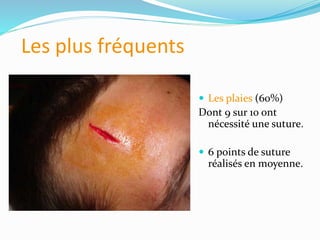 Les plus fréquents
 Les plaies (60%)
Dont 9 sur 10 ont
nécessité une suture.
 6 points de suture
réalisés en moyenne.
 