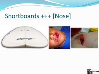 Shortboards +++ [Nose]
 