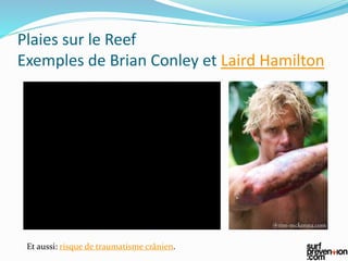 Plaies sur le Reef
Exemples de Brian Conley et Laird Hamilton
Et aussi: risque de traumatisme crânien.
 