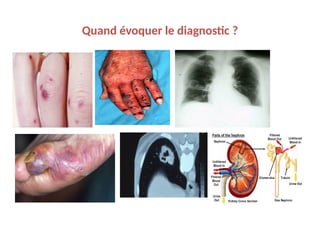 Quand évoquer le diagnostic ?
 