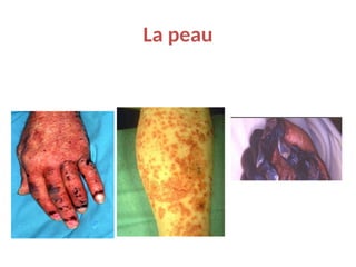 La peau
 
