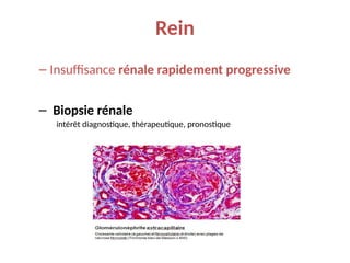 Rein
– Insuffisance rénale rapidement progressive
– Biopsie rénale
intérêt diagnostique, thérapeutique, pronostique
 