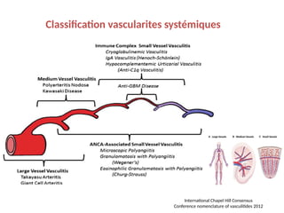 International Chapel Hill Consensus
Conference nomenclature of vasculitides 2012
Classification vascularites systémiques
 