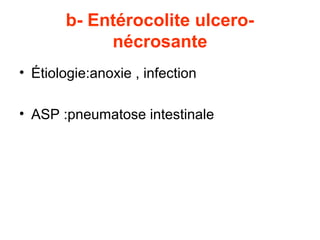 b- Entérocolite ulcero-
            nécrosante
• Étiologie:anoxie , infection

• ASP :pneumatose intestinale
 