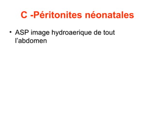 C -Péritonites néonatales
• ASP image hydroaerique de tout
  l’abdomen
 