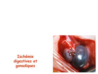 Ischémie
digestives et
 gonadiques
 