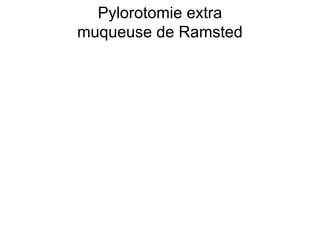 Pylorotomie extra
muqueuse de Ramsted
 