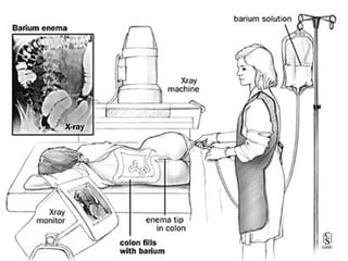 Les vomissements de l’enfant