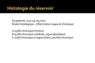 60 patients, suivi 19-173 mois 
Etude histologique : inflammation aigue et chronique 
A (45%) chronique mineure 
B (42%) chronique modérée, aigue épisodique 
C (13%) chronique et aigue sévère, pochite chronique 
 
