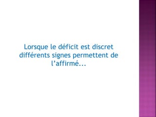 Lorsque le déficit est discret
différents signes permettent de
l’affirmé...

 