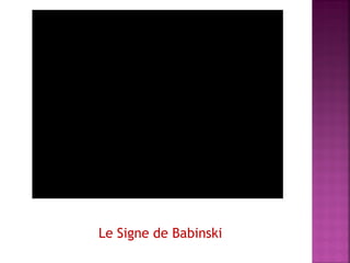 Le Signe de Babinski

 