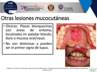Lupus eritematoso sistémico y síndrome antifosfolípido | PDF