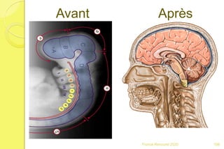 Avant Après
108Franck Rencurel 2020
 