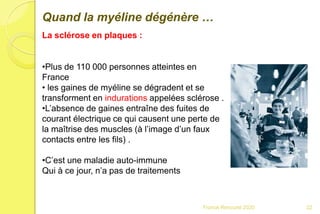 22
Quand la myéline dégénère …
La sclérose en plaques :
•Plus de 110 000 personnes atteintes en
France
• les gaines de myéline se dégradent et se
transforment en indurations appelées sclérose .
•L’absence de gaines entraîne des fuites de
courant électrique ce qui causent une perte de
la maîtrise des muscles (à l’image d’un faux
contacts entre les fils) .
•C’est une maladie auto-immune
Qui à ce jour, n’a pas de traitements
Franck Rencurel 2020
 