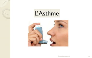 Franck Rencurel 2020 105
L’Asthme
 