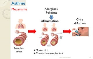 Asthme
Allergènes,
Polluants
inflammation Crise
d’Asthme
Bronches
saines Mucus +++
Contraction muscles +++
Mécanisme
107Franck Rencurel 2020
 