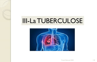 III-LaTUBERCULOSE
118Franck Rencurel 2020
 